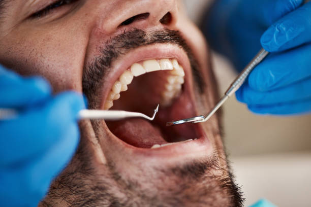 Best Emergency Root Canal Treatment in Sandy Springs, GA